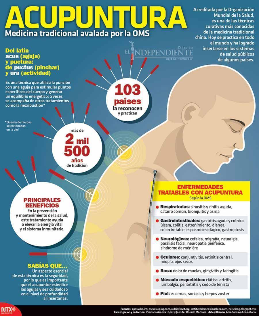 Acupuntura copia