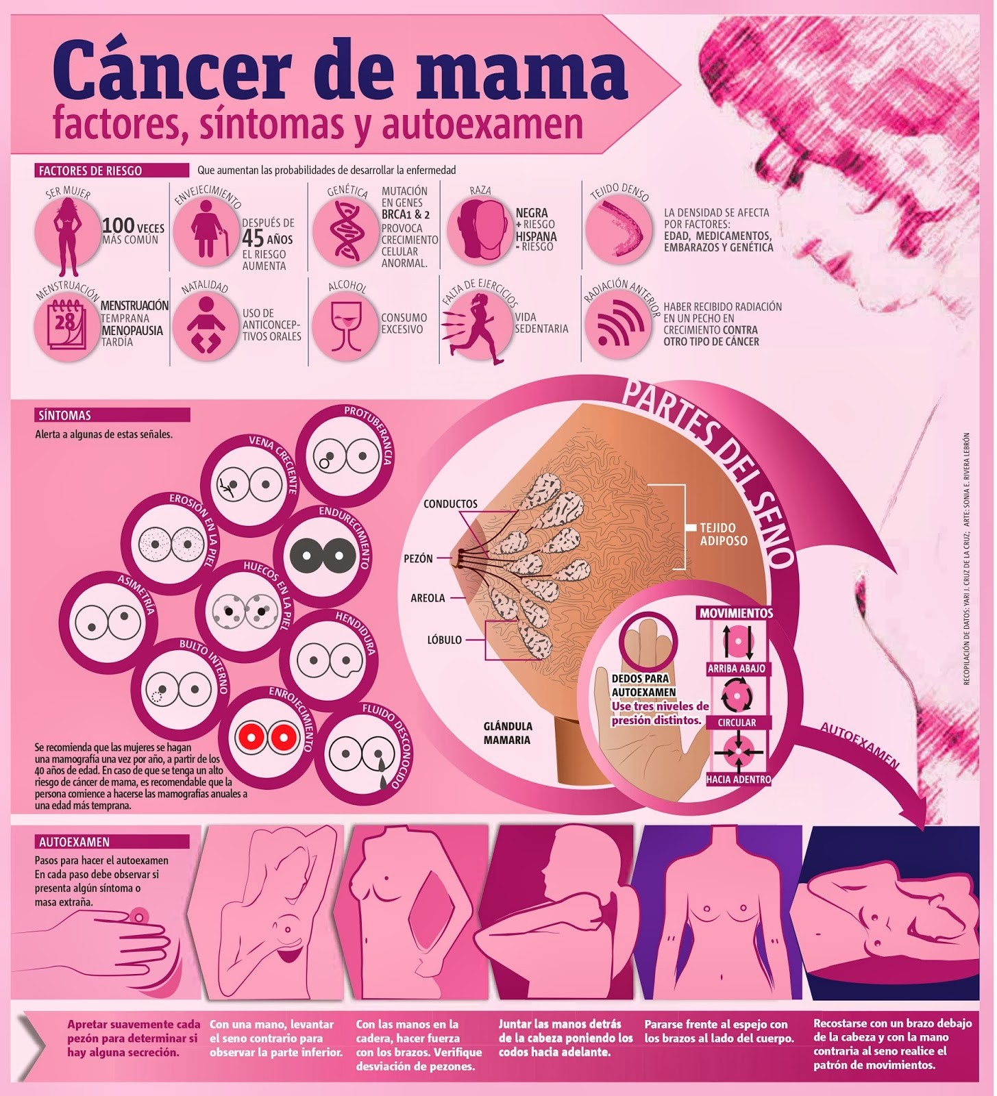 Cancer de mama