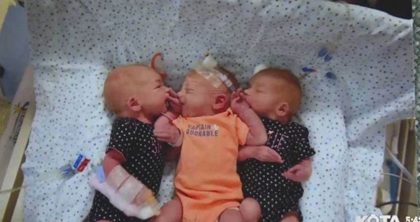 Creyó que tenía problemas renales... da a luz a trillizos