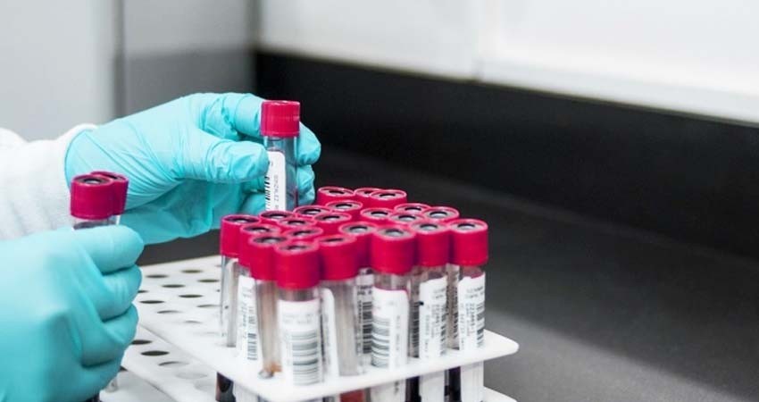 Análisis de sangre podrían ser clave para detener cirrosis hepática