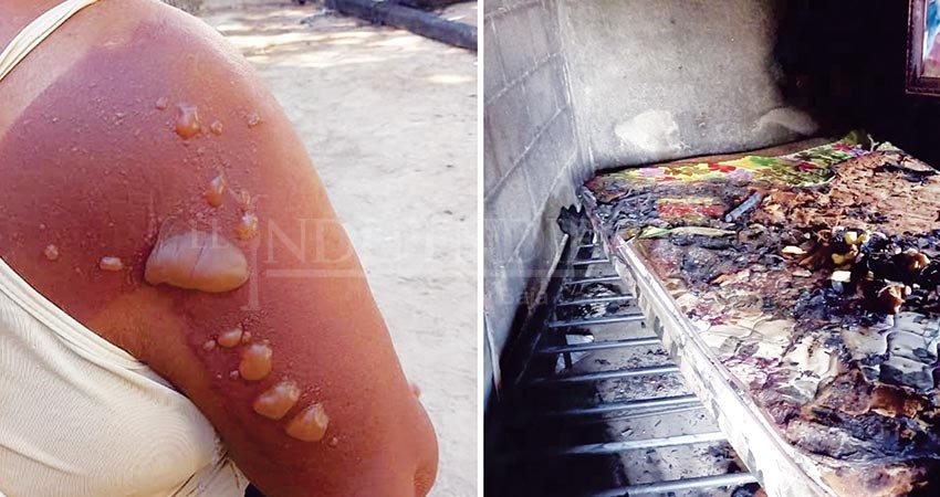 Incendio arrasó con su patrimonio; familia pide el apoyo ciudadano