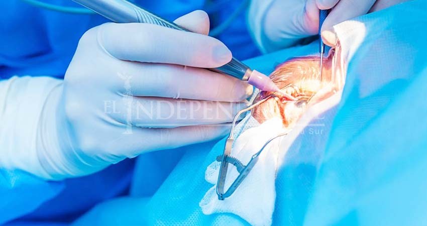 Beneficencia Pública dará cirugía de cataratas a 90 personas; piden apoyo a SSA