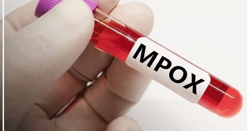 Confirman presunto “primer caso” de Mpox en Los Cabos; Hospital IMSS refuerza medidas de protección ante posibles contagios