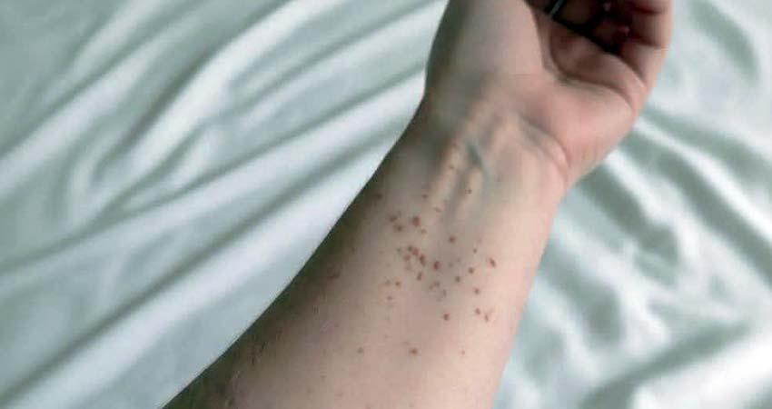 México en riesgo de perder certificado contra sarampión; BCS registró 8 casos