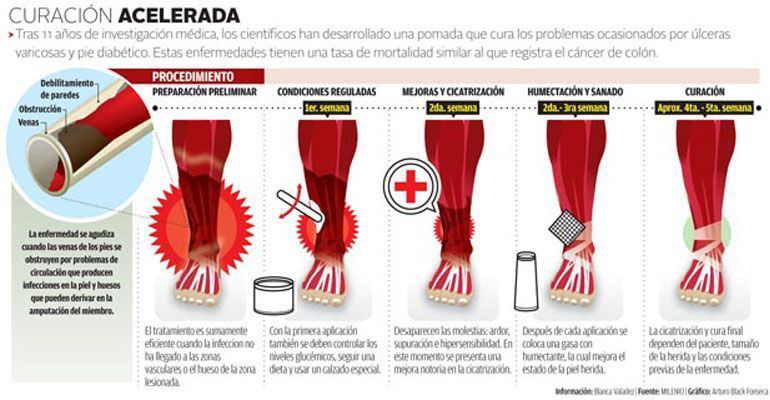 Mexicano desarrolla un gel que evita las amputaciones