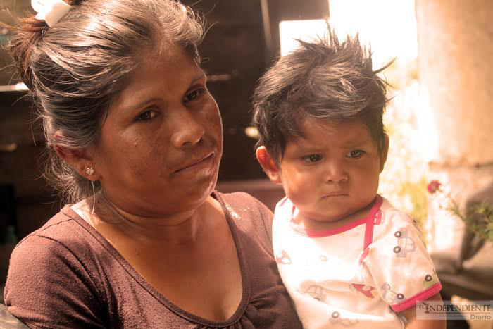 ¿Carne o pescado? muy pocas veces está en nuestra mesa porque el dinero ya ni para eso nos alcanza: doña Graciela