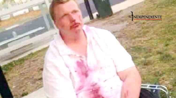 Adolescente golpea a joven con Síndrome de Down sin razón aparente