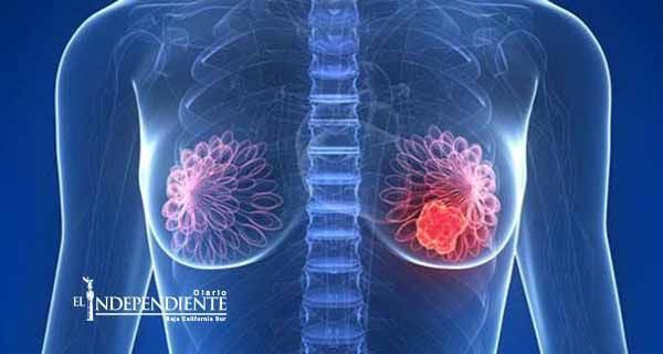 Los tumores de mama necesitan suministro de grasa para crecer