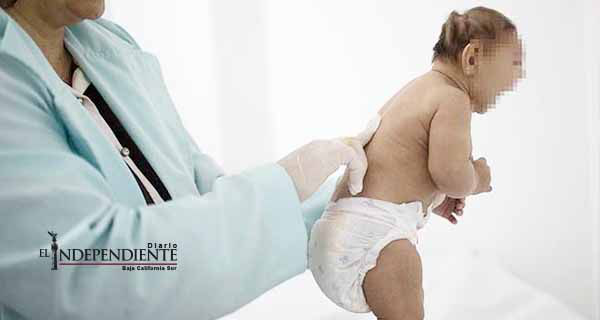 Estados Unidos confirma que zika causa microcefalia Estados Unidos confirma que zika causa microcefalia