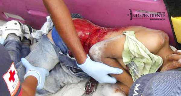 “Pesera” atropella a niño en CSL y le ocasiona heridas de consideración