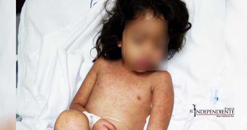 Niña que se salvó de morir ahogada en una alberca, ahora enfrenta una compleja enfermedad