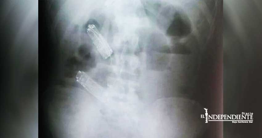 Preso muere una semana después de 'comerse' 3 celulares Preso muere una semana después de 'comerse' 3 celulares