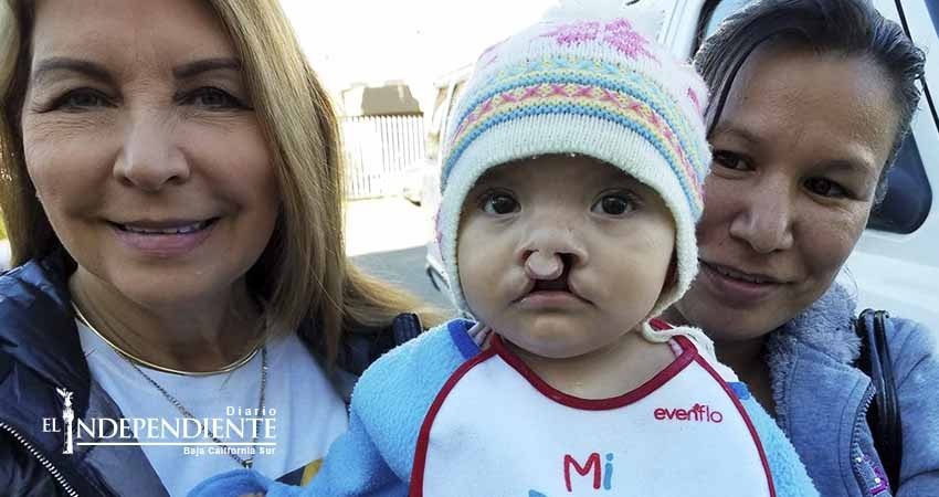 Termina otra exitosa jornada de cirugías de labio leporino y paladar hendido