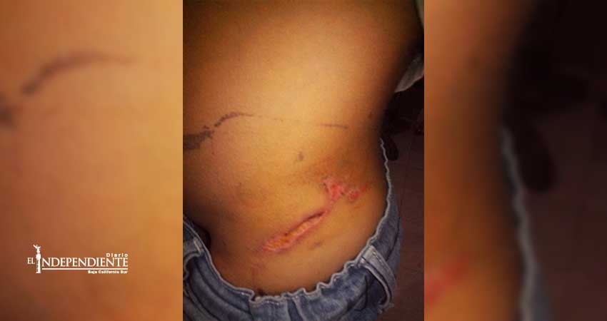 Sector Salud niega vacuna antirrábica a menor mordido por perro en el malecón Sector Salud niega vacuna antirrábica a menor mordido por perro en el malecón