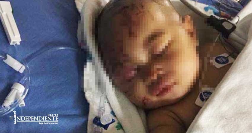 Mapache hiere de gravedad a bebé de cuatro meses en Filadelfia Mapache hiere de gravedad a bebé de cuatro meses en Filadelfia