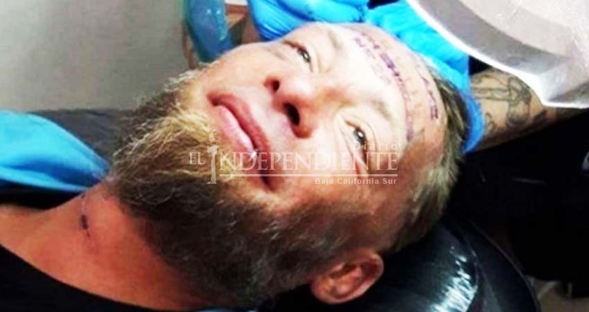 Británicos en despedida de soltero tatúan rostro de indigente