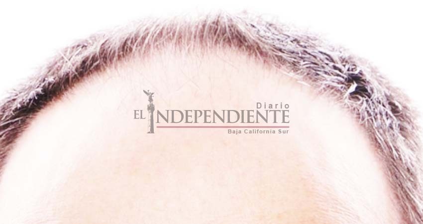 Descubren fármaco efectivo en el combate de la alopecia Descubren fármaco efectivo en el combate de la alopecia