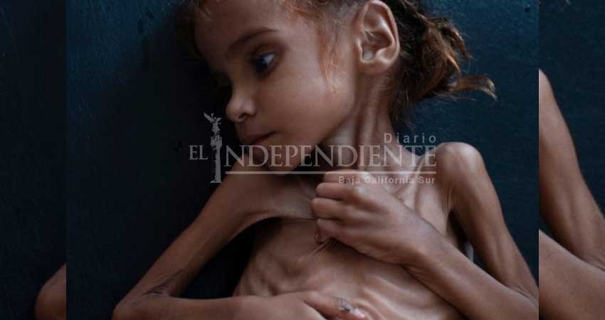 Muere Amal Hussain, la niña que mostró la hambruna en Yemen Muere Amal Hussain, la niña que mostró la hambruna en Yemen