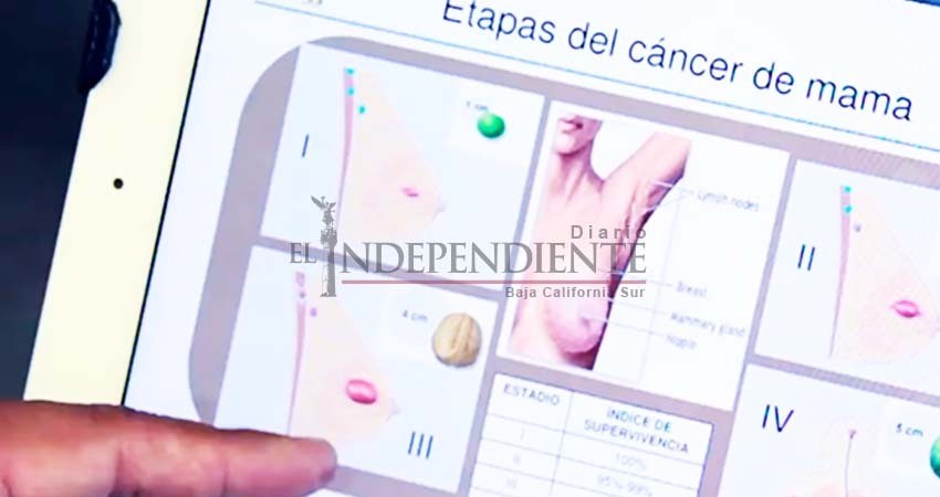 Científicos mexicanos detectan cáncer de mama con método de inmunodiagnóstico Científicos mexicanos detectan cáncer de mama con método de inmunodiagnóstico