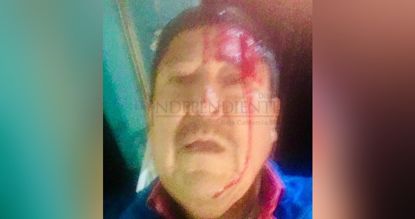 Con un bate golpean a reportero de Ciudad Constitución