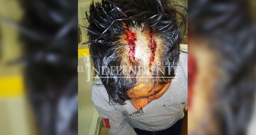 Violento asalto, encapuchados lo golpean salvajemente para robarle 100 pesos y su celular Violento asalto, encapuchados lo golpean salvajemente para robarle 100 pesos y su celular