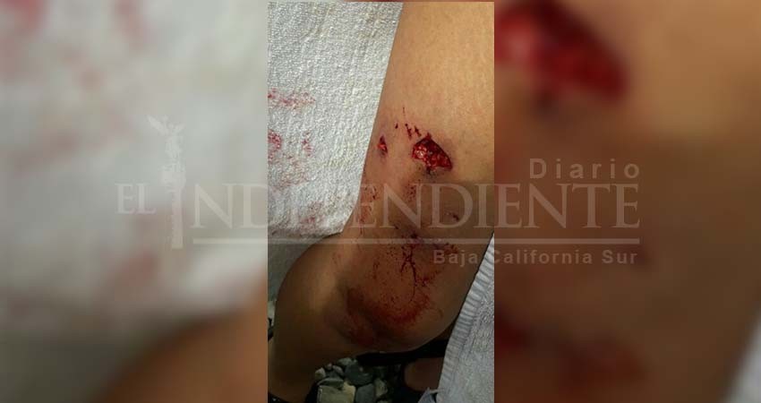 Dos personas mordidas por perros en Cabo San Lucas