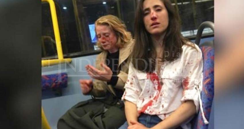 Golpean cruelmente a pareja de mujeres gay en Londres Golpean cruelmente a pareja de mujeres gay en Londres