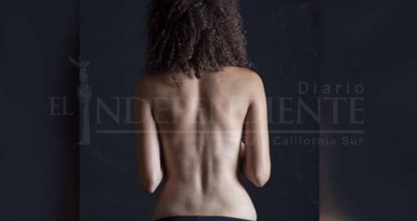 Instagram produce demanda de hoyuelos de Venus ficticios Instagram produce demanda de hoyuelos de Venus ficticios