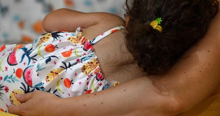 Error de farmacéutica causa bebés 'peludos' Error de farmacéutica causa bebés 'peludos'