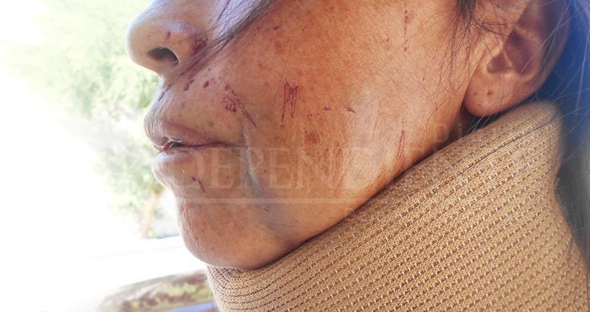 Pide justicia madre de familia que fue golpeada por una pareja en La Ribera Pide justicia madre de familia que fue golpeada por una pareja en La Ribera