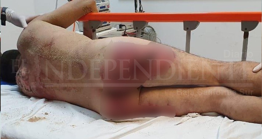 Torturan a presunto ladrón en colonia Chulavista de CSL Torturan a presunto ladrón en colonia Chulavista de CSL
