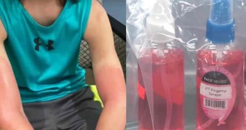 Vende gel antibacterial adulterado y niño termina en el hospital Vende gel antibacterial adulterado y niño termina en el hospital
