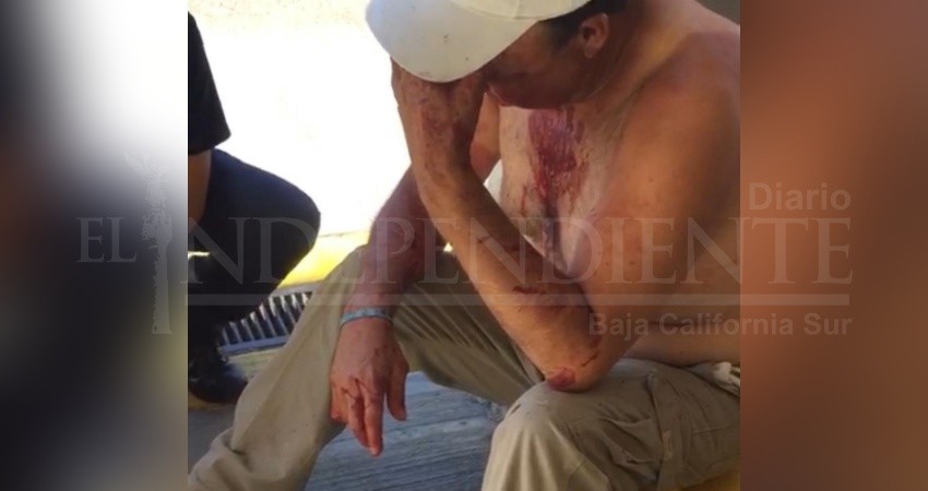 Tras asaltarlo en CSL, lo golpearon brutalmente Tras asaltarlo en CSL, lo golpearon brutalmente