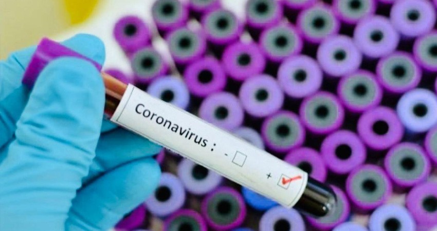Detectan 2 casos más; ya son 8 infectados por COVID-19 en BCS Detectan 2 casos más; ya son 8 infectados por COVID-19 en BCS