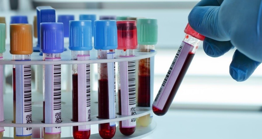 Ningún laboratorio particular de BCS tiene autorización para hacer pruebas COVID-19: Coepris