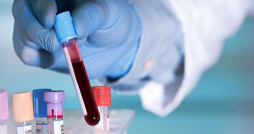 Aumentan a 146,837 los casos positivos de covid-19 en México