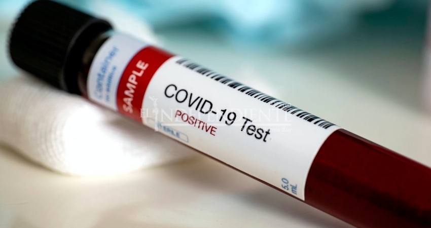 BCS con 2,163 contagios y 196 muertes por COVID-19 BCS con 2,163 contagios y 196 muertes por COVID-19