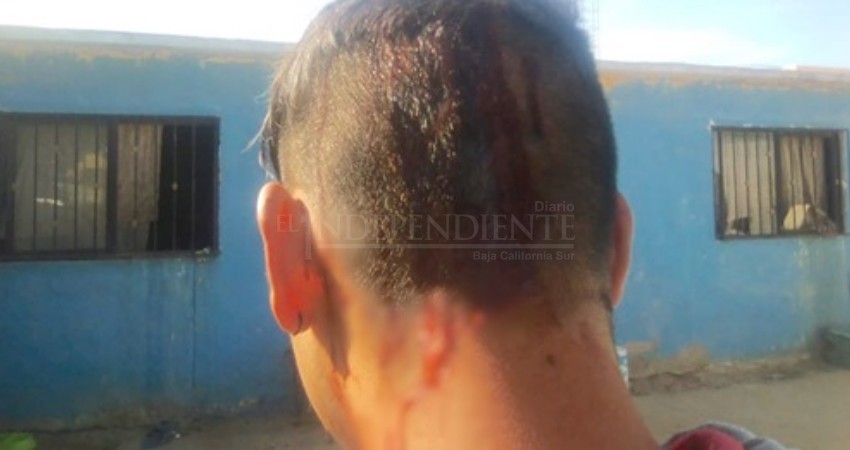 Le abrió la cabeza a su sobrino de un botellazo Le abrió la cabeza a su sobrino de un botellazo