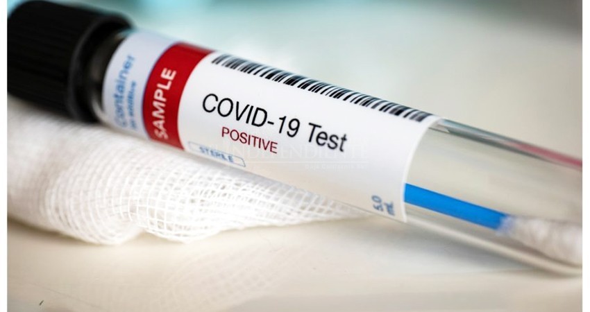 Inician Empresarios Playa El Médano aplicación de pruebas Covid a visitantes Inician Empresarios Playa El Médano aplicación de pruebas Covid a visitantes