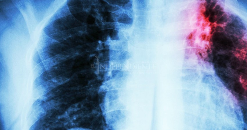 Más de 4 mil sudcalifornianos presentan secuelas por Covid-19