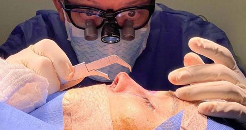 Más que estética… la rinoplastia ayuda a mejorar la respiración del paciente