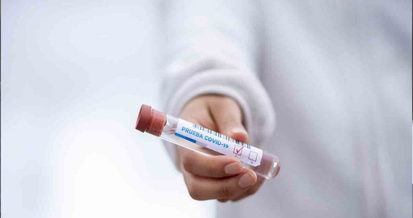 ¿Qué es la infección posvacuna Covid? Te decimos