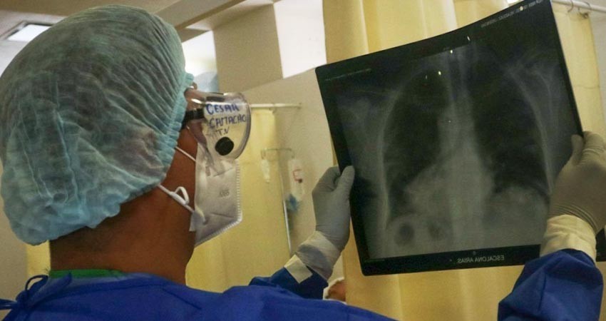 Especialistas del IMSS atienden secuelas pulmonares del Covid-19 Especialistas del IMSS atienden secuelas pulmonares del Covid-19