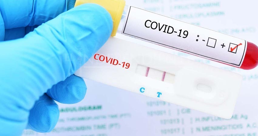 Denuncia aumento de costo en pruebas Covid