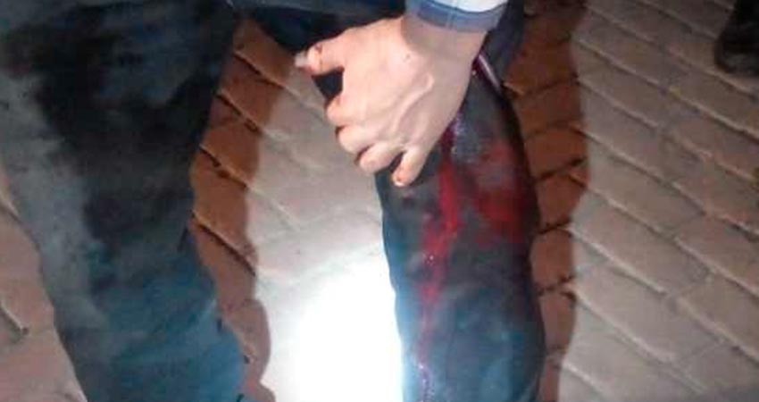 Sufre grave herida en una pierna a manos de un desconocido Sufre grave herida en una pierna a manos de un desconocido