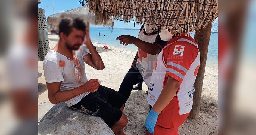 Turista extranjero es lesionado por un hombre en El Malecón de La Paz