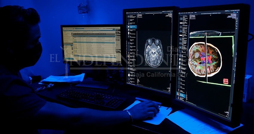 Prevenibles, 90% de casos de accidente cerebrovascular asociados con obesidad e hipertensión: Issste