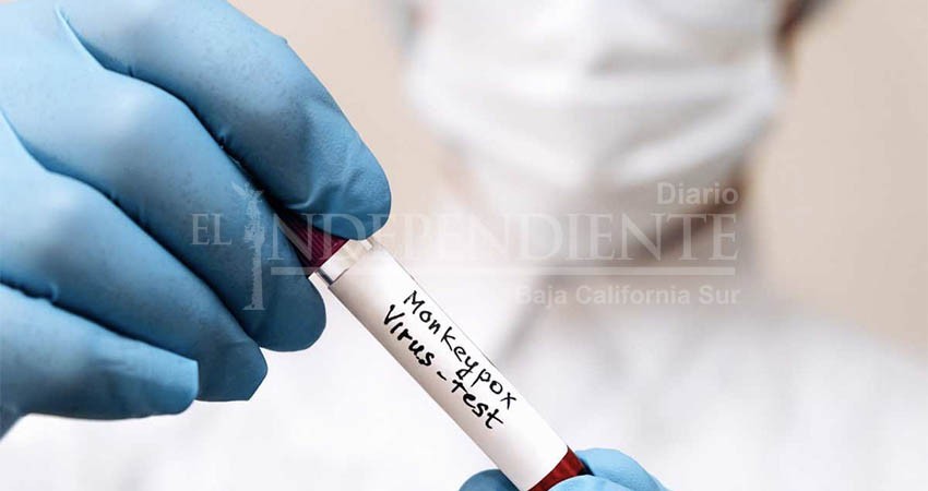 Descarta INDRE nuevos casos de viruela del mono en BCS