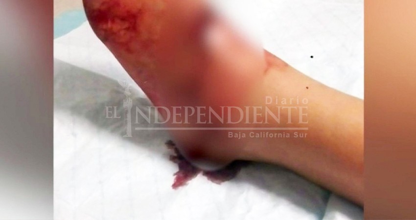 Se dispara en el pie elemento de Guardia Nacional en Loreto Se dispara en el pie elemento de Guardia Nacional en Loreto