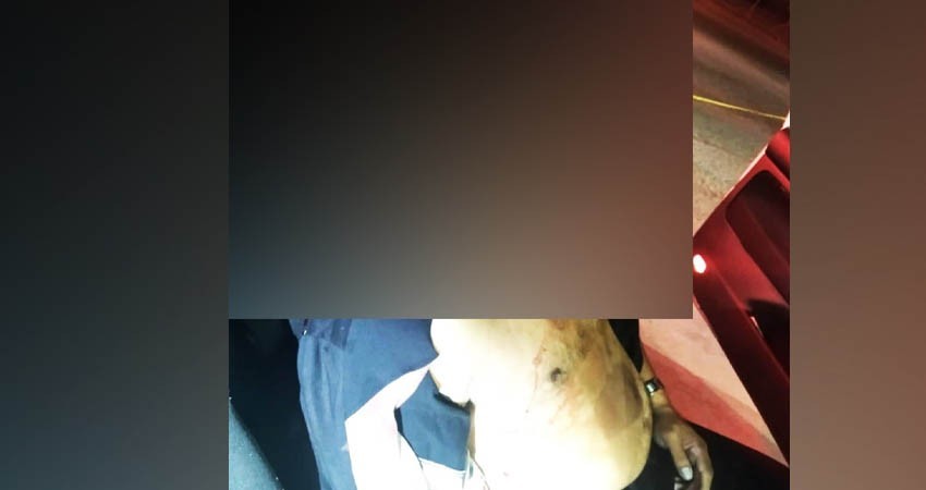 A balazos asesinan a un hombre en SJC